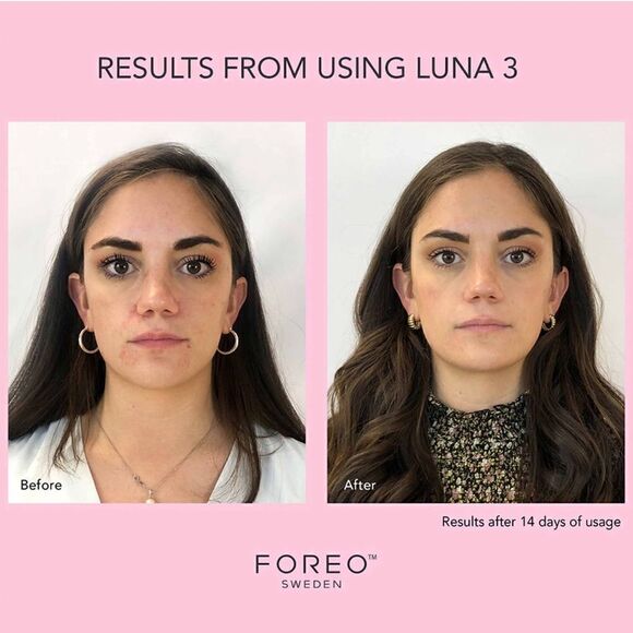 FOREO LUNA 3 Normal skin - Picture 7 of 10